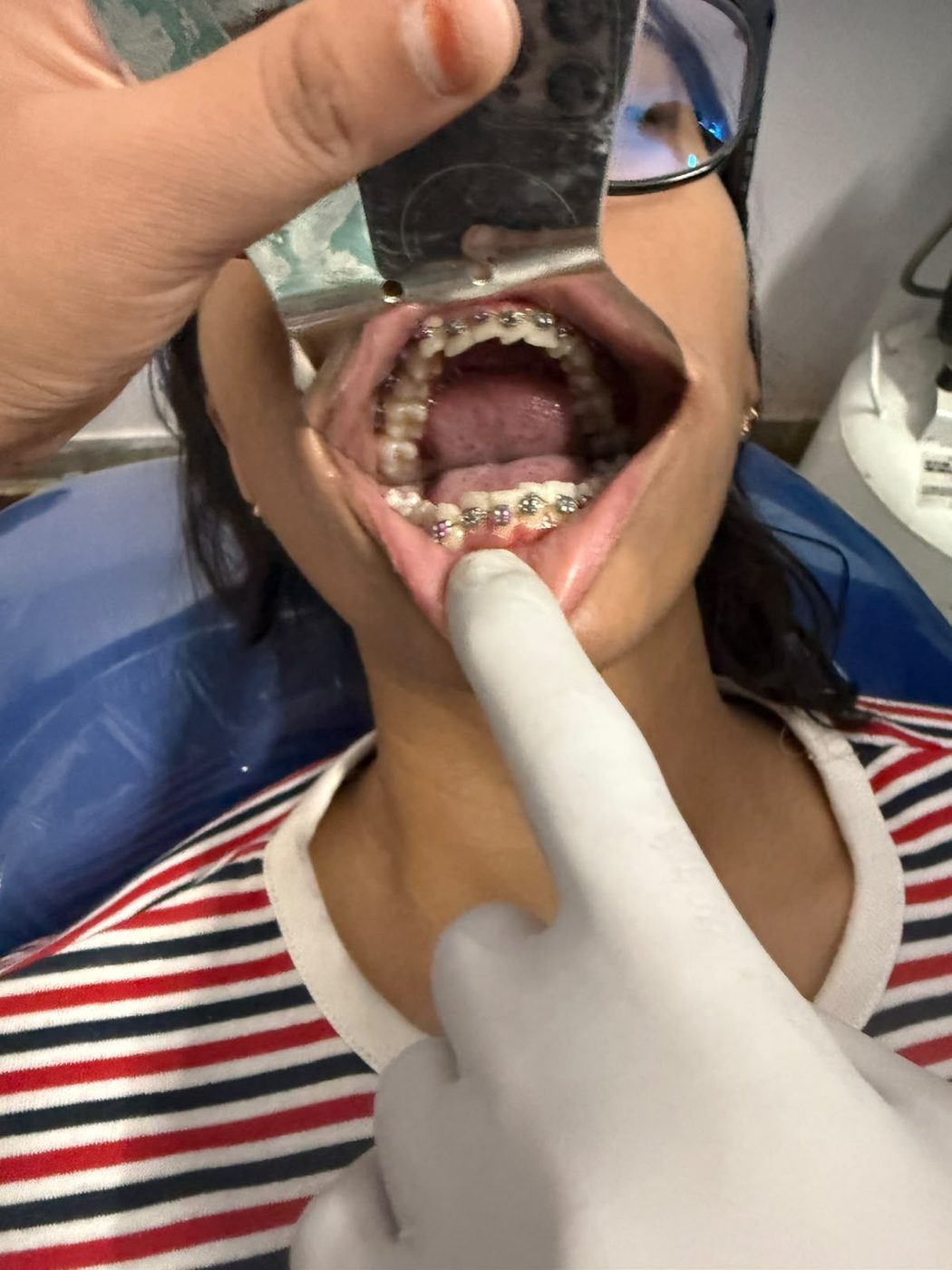 Dentist performing a detailed dental examination for an adult patient at Happy Tooth, Pune